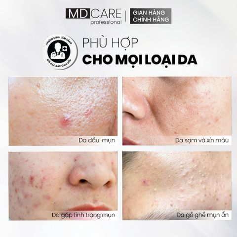 Sữa Rửa Mặt Bọt MD CARE BHA Cho Da Dầu Mụn Nhạy Cảm 200ml - Giải Pháp Làm Sạch Sâu, Kiểm Soát Dầu và Ngăn Ngừa Mụn