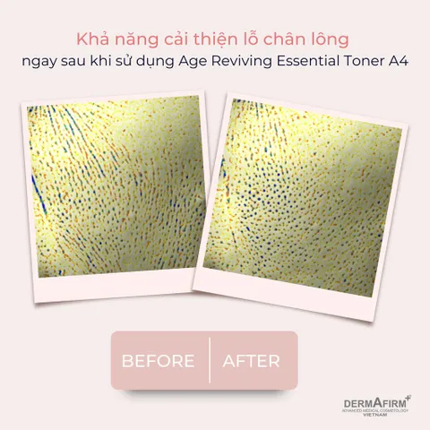 Nước Cân Bằng Dermafirm Age Reviving Essential Toner A4 - Chống Lão Hóa, Cấp Ẩm, Làm Sáng Da 200ml Hàng Nhập Khẩu