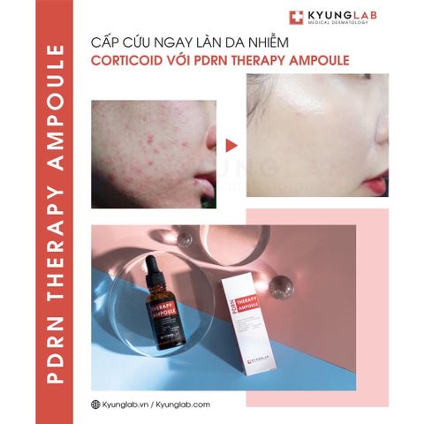 Serum Tế Bào Gốc KyungLab PDRN 30ml - Phục Hồi, Chống Lão Hóa, Làm Sáng Da, Dưỡng Ẩm, Cho Da Khô và Hỗn Hợp