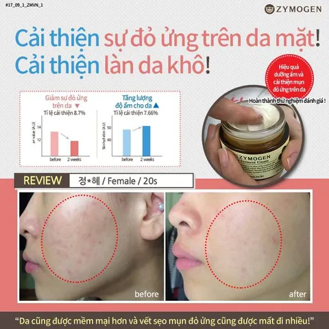 Kem Dưỡng Rau Má Lên Men Zymogen Centella Ferment Cream - Chống Lão Hóa, Tái Tạo Da, Ngừa Mụn, Mờ Thâm, Làm Dịu Da