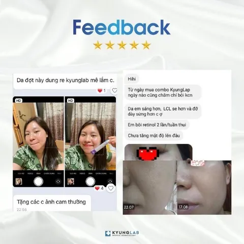 Kem Dưỡng Retinol Kyung Lab Alab Cream 30ml - Chống Lão Hóa, Giảm Nhờn, Ngăn Ngừa Mụn, Se Khít Lỗ Chân Lông, Da Sáng Mịn