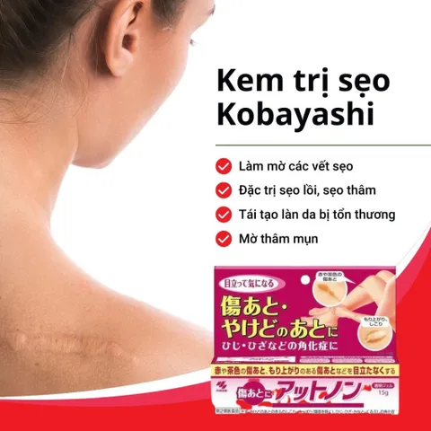 Kem Mờ Sẹo Ex Kobayashi 15g - Giải Pháp Làm Sáng Da, Mờ Thâm Mụn, Sẹo Lồi và Sẹo Rỗ Nhập Khẩu Nhật Bản