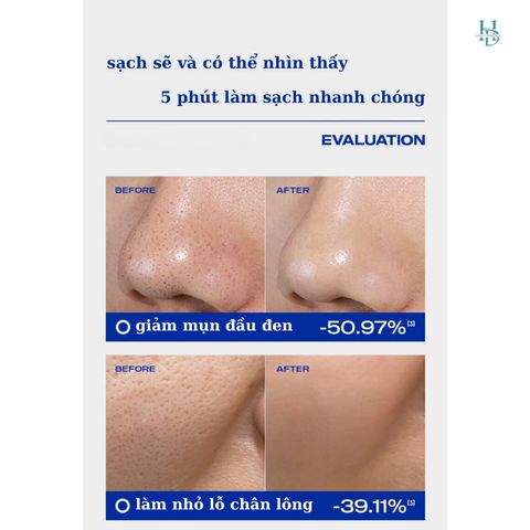 Mặt Nạ Đất Sét Blueman 40g - Làm Sạch Sâu, Giảm Mụn, Mờ Thâm Từ Thiên Nhiên - Chăm Sóc Da Mặt Hiệu Quả