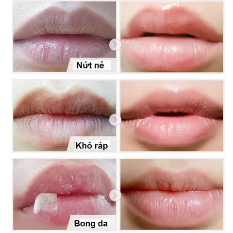 Son môi dưỡng cho nam son dưỡng môi nam giới Blueman cấp ẩm chống nứt nẻ 10g - Hudu Cosmetics