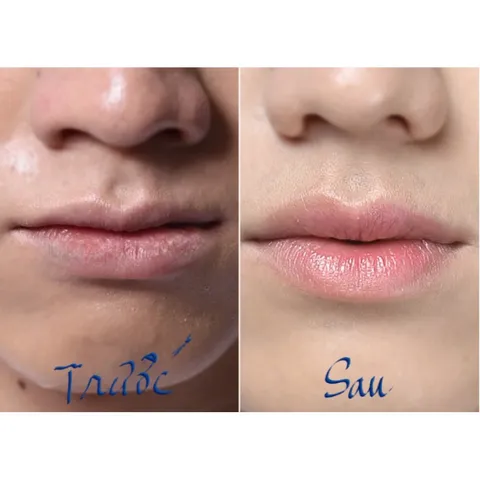 Son môi dưỡng cho nam son dưỡng môi nam giới Blueman cấp ẩm chống nứt nẻ 10g - Hudu Cosmetics