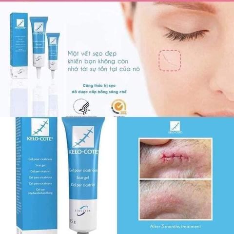 Gel Sẹo Kelo Cote Mỹ - Kem Hỗ Trợ Làm Mờ Sẹo Phẫu Thuật và Sẹo Sinh Mổ - Hộp 6g/15g Giúp Làm Mềm Vết Sẹo