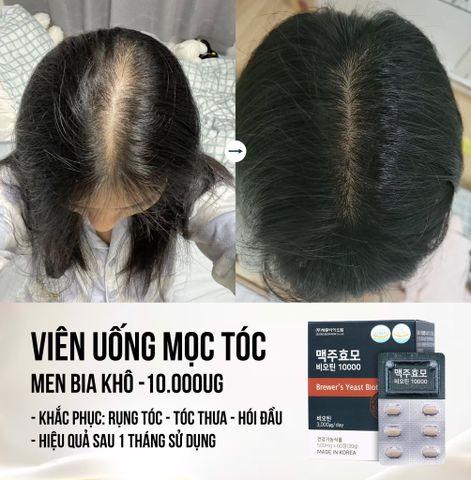 Viên Uống Hỗ Trợ Mọc Tóc Biotin Brewer's Yeast Sejong - Hộp 60 Viên, Giúp Tóc Khỏe, Giảm Rụng, Tăng Độ Dày Tóc