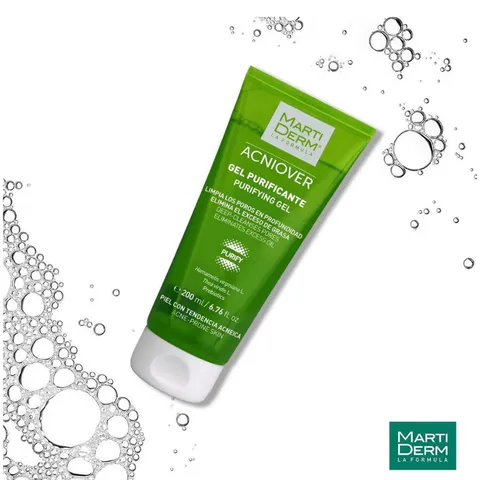 Martiderm Acniover Gel Rửa Mặt Cho Da Dầu & Mụn 200ml - Dưỡng Ẩm Sâu, Chống Oxy Hoá, Se Khít Lỗ Chân Lông, Chính Hãng