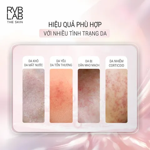 RVB LAB THE SKIN Huyết Thanh Làm Dịu Da Nhạy Cảm - Cân Bằng, Phục Hồi, Giảm Sưng Đỏ, Tổn Thương Corticoid 30ml