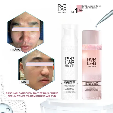 Tinh Chất Cân Bằng Da Mụn RVB LAB THE SKIN 30ml - Serum Giảm Sưng Đỏ, Kiểm Soát Dầu, Thu Nhỏ Lỗ Chân Lông, Phù Hợp Da Nhạy Cảm
