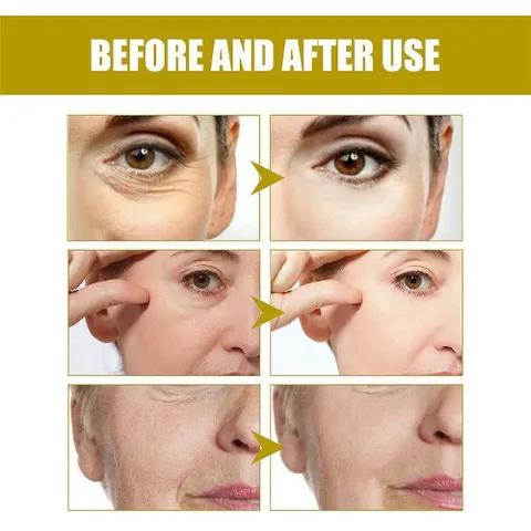 HD Derma Professional Hydrating Relaxaderm - Tinh Chất Dưỡng Ẩm Toàn Diện Cấp Nước 48 Giờ, Làm Sáng Mịn Da