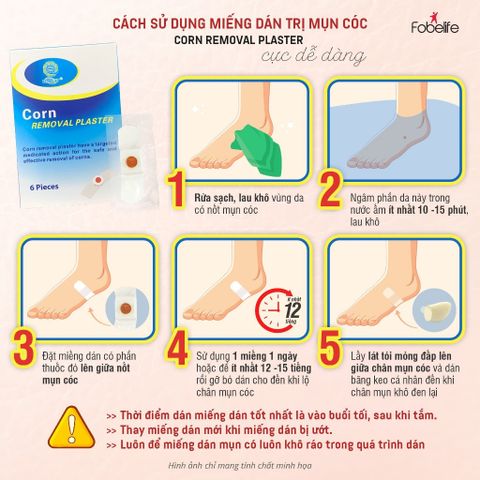 Miếng Dán MỤN CÓC Mụn Cơm Corn plaster KangDi Fobe N1 - hộp 6 miếng