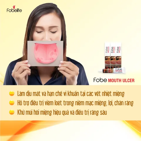 Gel Nhiệt Miệng Fobe - Chai 10/15g, Giảm Đau Nhanh, Chống Viêm Loét Miệng Từ Thiên Nhiên, Đạt Chuẩn GMP