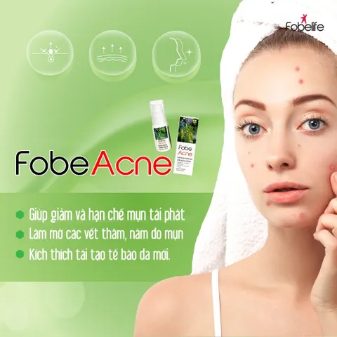 Kem Ngừa Thâm Mụn Tái Tạo Da - Giảm Thâm Mụn, Kích Thích Tái Tạo Da, Chăm Sóc Da Mặt 15g