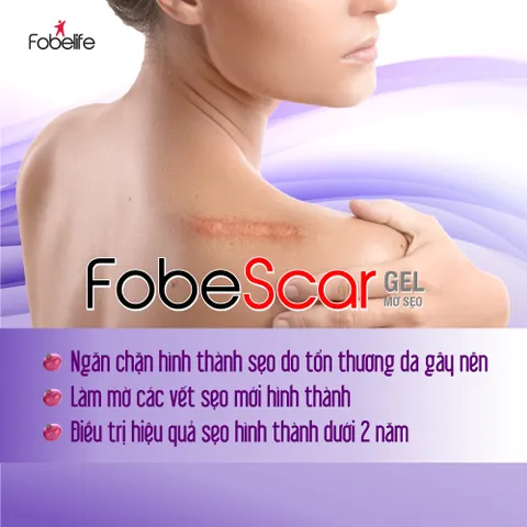 Gel Mờ Sẹo Fobe Scar N1 10g - Giảm Vết Thâm, Ngăn Hình Thành Sẹo, Dưỡng Da Mặt, Sản Phẩm Chăm Sóc Da Chất Lượng