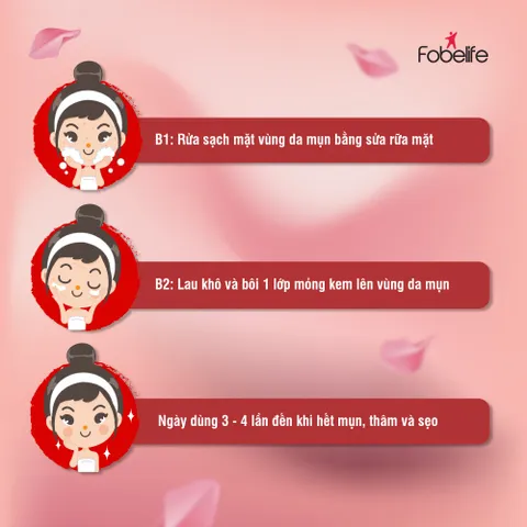 Combo 3 Kem Giảm Mụn Đầu Đen, Đầu Trắng và Mụn Cám ACNEVIR SANTAFA 15gr - Giải Pháp Đặc Trị Da Mụn Hiệu Quả