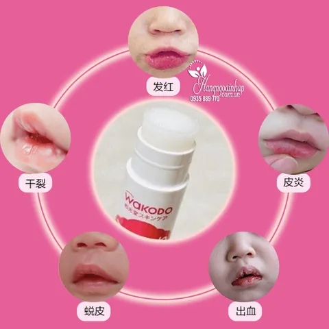 Son Dưỡng Môi Cho Bé WAKODO Nhật Bản - Dưỡng Ẩm và Phục Hồi Da Nhạy Cảm - An Toàn Cho Trẻ Sơ Sinh
