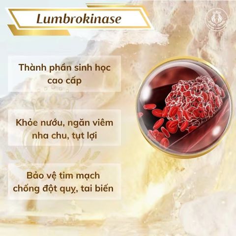 Kem đánh răng Vsmile - Giúp hơi thở thơm mát, ngăn ngừa mảng bám, chăm sóc răng miệng và ngừa đột quỵ hiệu quả