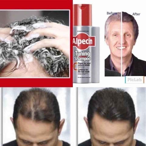 Dầu gội ALPECIN Tuning Shampoo 200ml - Chống rụng tóc và làm đen tóc bạc, cứu tinh cho mái tóc chắc khỏe