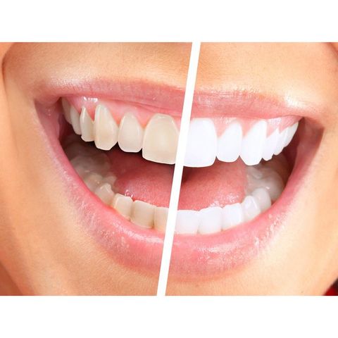 Kem Đánh Răng Ajona 25ml - Chăm Sóc Răng Miệng Trắng Sáng, Ngăn Ngừa Hôi Miệng và Viêm Nướu, Phù Hợp Mọi Lứa Tuổi