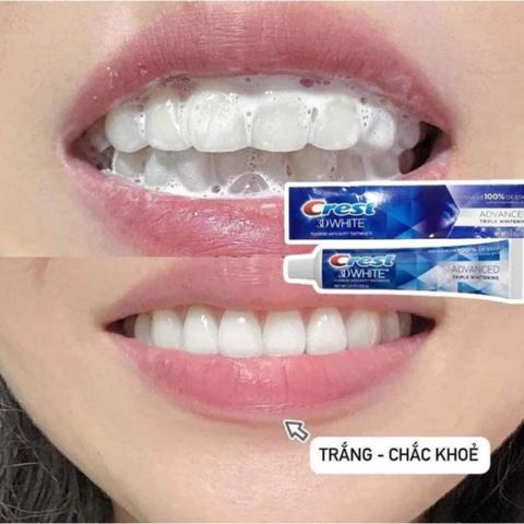 Kem đánh răng CREST 3D White Advanced Triple Whitening