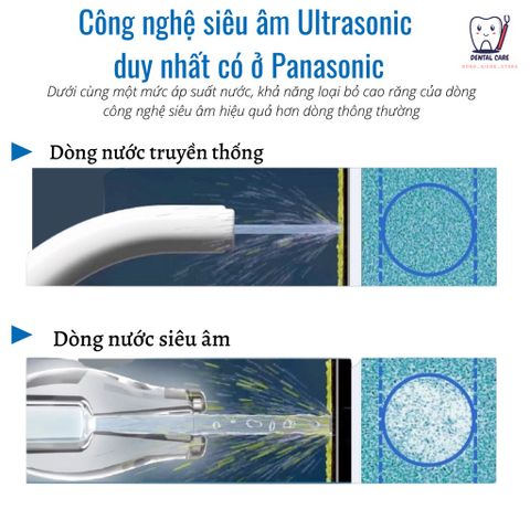TĂM NƯỚC PANASONIC EW1511-CÔNG NGHỆ SIÊU ÂM MỚI NHẤT, XỊN XÒ NHẤT