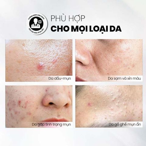MD CARE Sữa Rửa Mặt BHA Dạng Bọt - Giảm Nhờn, Ngăn Ngừa Mụn, Làm Sạch Lỗ Chân Lông, Dưỡng Ẩm Cho Da Dầu & Nhạy Cảm (200ml)