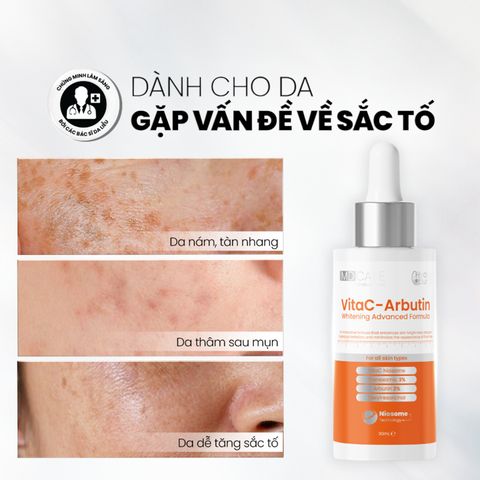 Serum Trắng Da MD CARE VITAC Arbutin - Chống Lão Hóa, Mờ Nám, Thâm Mụn, Cải Thiện Đều Màu Da, 30ml