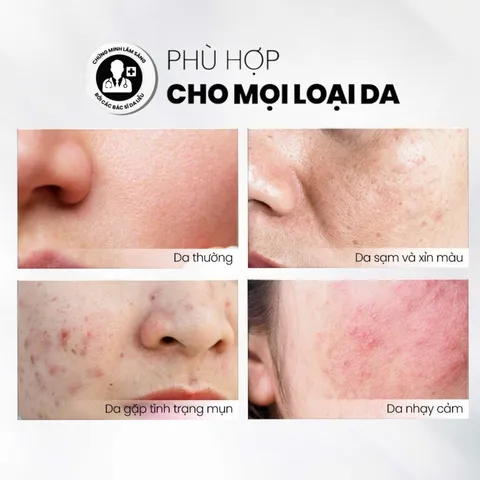 Tẩy Tế Bào Chết MD CARE Glow Exfo 10ml - AHA Làm Sáng Da, Giảm Thâm, Đều Màu Da, Phục Hồi Da Mụn
