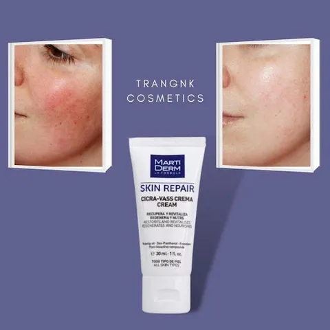 Kem Dưỡng Tái Tạo Da Nhạy Cảm Martiderm Skin Repair Cicra-Vass Cream 2ml - Chăm sóc làn da tổn thương, làm dịu và phục hồi nhanh chóng