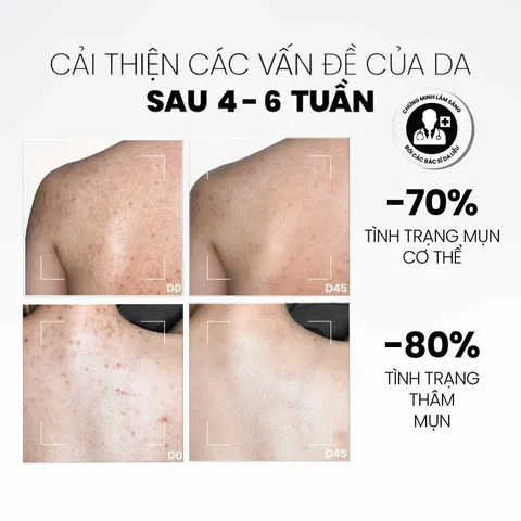 MD CARE Tẩy Tế Bào Chết Body AHA BHA Exfoliating Body Spray 100ml - Giảm Mụn Lưng, Làm Sáng Da, Phục Hồi Kết Cấu Da