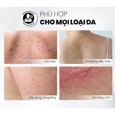 MD CARE Tẩy Tế Bào Chết Body AHA BHA Exfoliating Body Spray 100ml - Giảm Mụn Lưng, Làm Sáng Da, Phục Hồi Kết Cấu Da