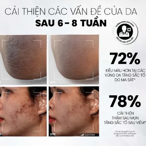 Kem Dưỡng Sạch Da MD CARE - Mờ Thâm Mụn, Nám và Tàn Nhang, Tăng Cường Độ Sáng và Collagen, Dành Cho Da Nhạy Cảm 50ml