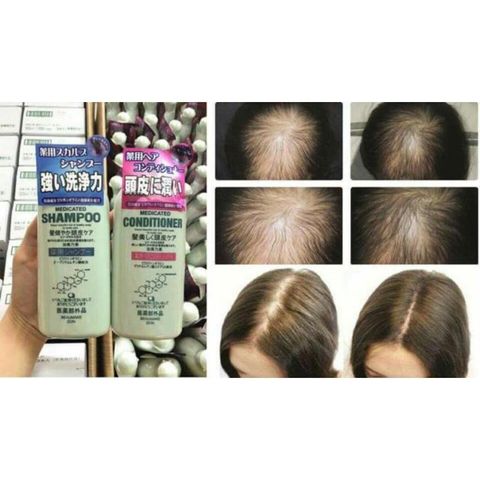 Dầu Gội & Xả KAMINOMOTO Nhật Bản 300ml - Giải Pháp Kích Thích Mọc Tóc Hiệu Quả, Chăm Sóc Sức Khỏe Tóc Tương Tác Thiên Nhiên