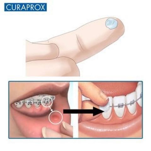 Sáp nha khoa Dentek Wax For Braces cho răng niềng 1 vỉ (USA)