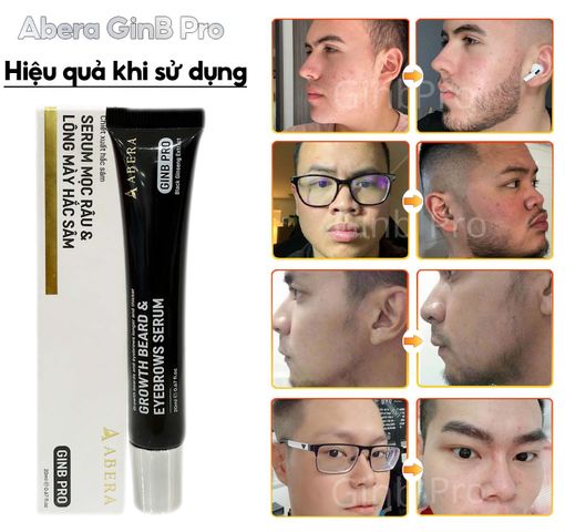 Serum GINB PRO 20ml Dưỡng Lông Mày & Râu - Hỗ Trợ Làm Đầy & Đậm Mày Râu, Sản Phẩm Chăm Sóc Da Từ Thương Hiệu ABERA