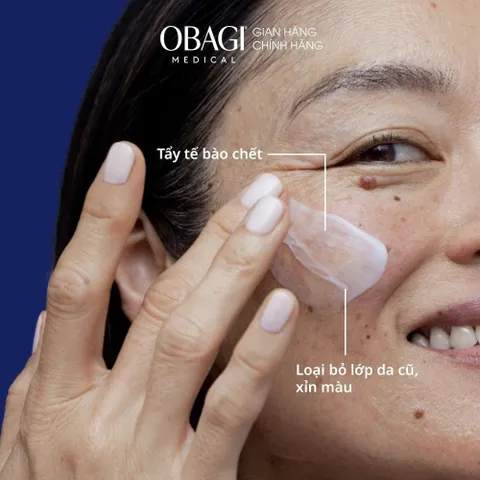 OBAGI Medical Exfoderm Forte Lotion AHA - Tinh Chất Tẩy Da Chết, Kiềm Dầu, Giảm Mụn, Mờ Thâm, Sáng Da 150ml