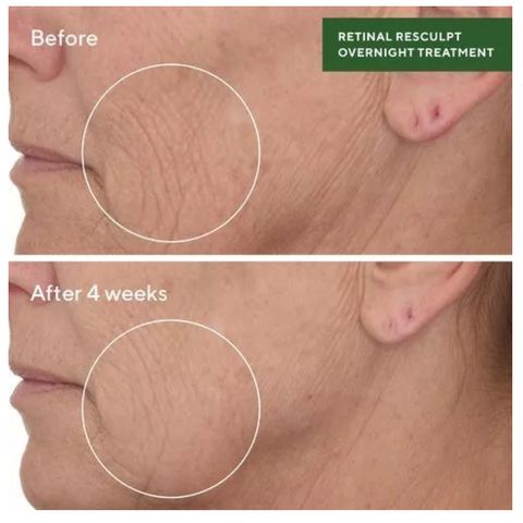 Tinh Chất Chống Lão Hóa Murad Retinal ReSculpt - Serum Tăng Độ Đàn Hồi & Săn Chắc Da, Trẻ Hóa Da Ban Đêm