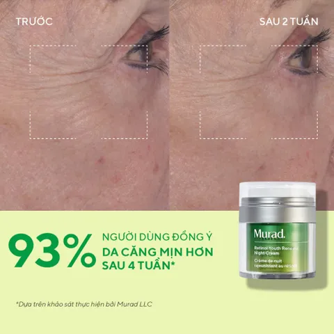 Kem Dưỡng Ẩm Chống Lão Hóa Murad Retinol Youth Renewal Cream - Làm Mờ Nếp Nhăn, Da Săn Chắc, Mịn Màng, Dưỡng Ẩm Hiệu Quả