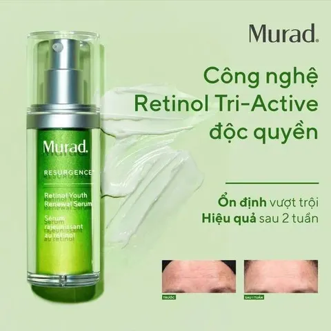 Serum Chống Lão Hóa Murad Retinol Youth Renewal - Làm Mờ Nếp Nhăn, Săn Chắc Da, Trẻ Hóa Da, Tinh Chất Chất Lượng Cao