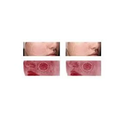 Kem Dưỡng Phục Hồi Da RVB LAB THE SKIN RICH với Pre-Probiotics, Dưỡng Ẩm và Chống Lão Hóa Cho Da Khô, Nhạy Cảm