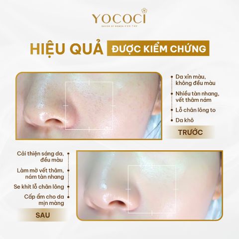 Kem Dưỡng Trắng Da Mặt Ngày & Đêm YOCOCI Perfect Face Cream 20g – Dưỡng Ẩm, Mờ Thâm Nám, Chống Oxy Hóa, Phục Hồi Da