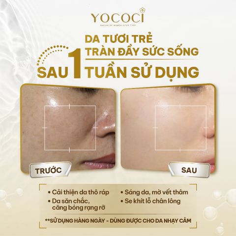 Nước Hoa Hồng Yococi Perfect Oolong Toner 110g - Dưỡng Da Mịn Màng, Cân Bằng Độ pH, Dưỡng Ẩm Cho Mọi Loại Da