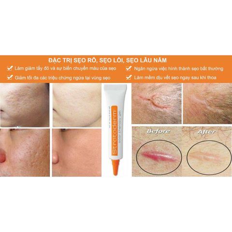 Combo Gel Silicone Strataderm & Stratamed cho vết thương hở, hỗ trợ ngăn ngừa sẹo xấu, làm mềm và phẳng vết sẹo, hiệu quả cao.