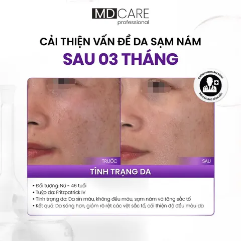 Kem Dưỡng Trắng Da Giảm Thâm Nám MDCare A.R.T BRIGHTENING COMPLEX - Sản Phẩm Chăm Sóc Da Từ Thiên Nhiên, Dành Cho Mọi Loại Da