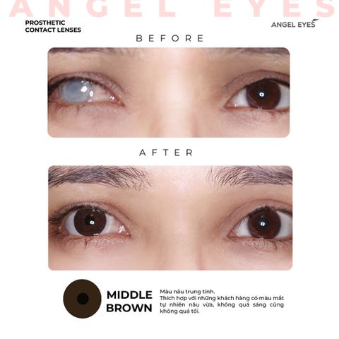 Kính áp tròng thẩm mỹ Angel Eyes - Lens che khuyết điểm cho mắt bị đục thủy tinh thể, cườm, thiết kế thời trang Hàn Quốc