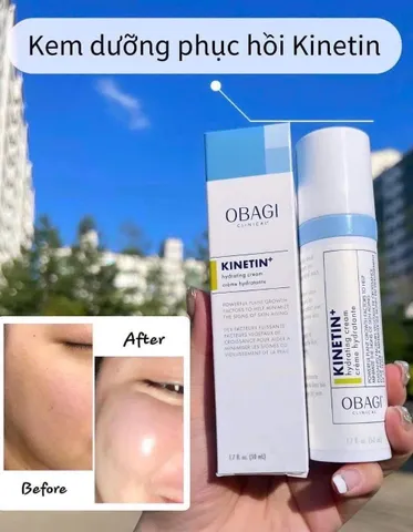 Kem Dưỡng Phục Hồi Olay Obagi Clinical Kinetin+ 50ml - Kem Dưỡng Ẩm, Phục Hồi Da Tay Mềm Mịn, Giúp Trị Nứt Nẻ, Bảo Vệ Da Tự Nhiên