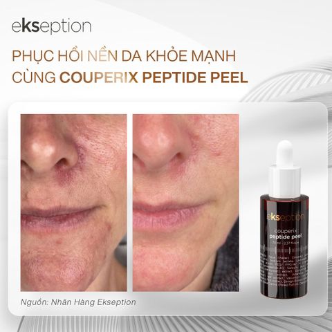 Tinh Chất Tẩy Da Chết Ekseption Couperix Peptide Peel 70ml - Dưỡng Da, Làm Sạch Tế Bào Chết, Phục Hồi Da Tươi Sáng, trẻ Hóa