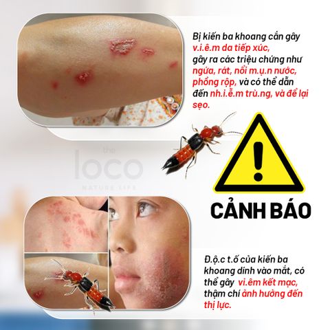 Chai Xịt Đuổi Kiến The Loco 280ml - Giải Pháp Đuổi Côn Trùng Tự Nhiên An Toàn, Đuổi Kiến, Gián, Muỗi Hiệu Quả