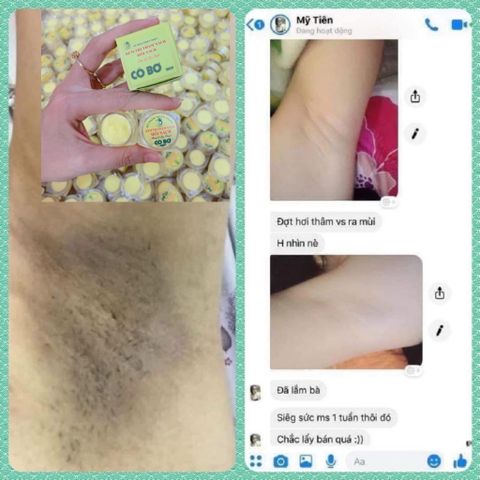 Kem giảm thâm nách Cô Bơ - Khử mùi hôi nách 100% thiên nhiên, an toàn cho mẹ bầu và trẻ em, hũ nhỏ 8gr